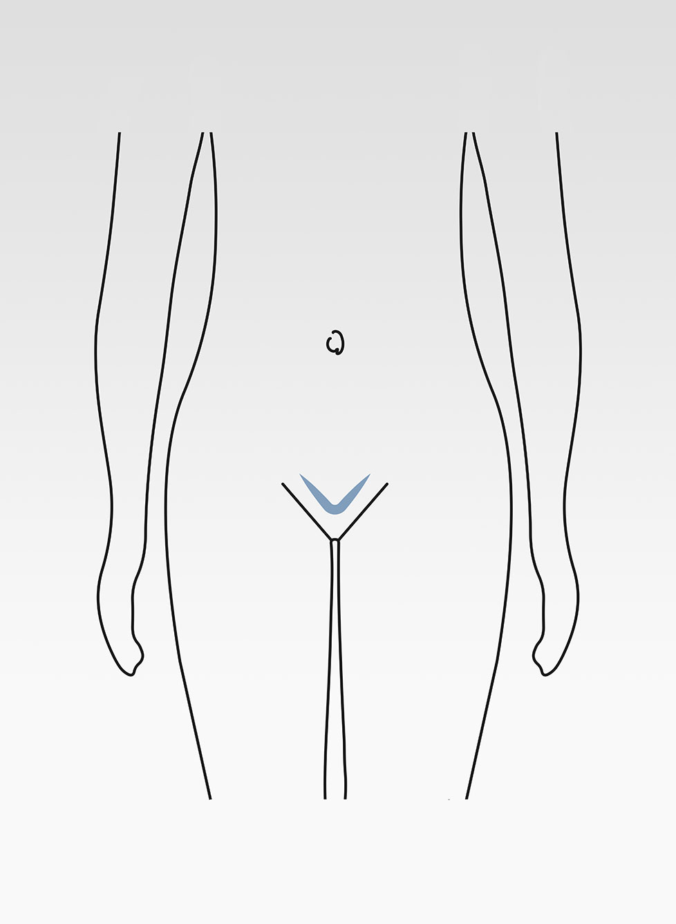 ThermaGyn-douche-vaginale-eau-hyperthermale-100ml-4
